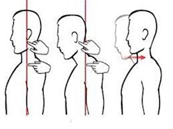 چند حرکت اصلاحی برای درمان قوز گردن