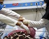 توضیح علوم پزشکی اهواز درباره روند درمان یک بیمار در ایذه