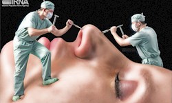 مدهایی که می‌آیند و خیلی زود از مد می‌افتند