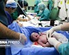 تاریخ‌های رُند، سزارین‌های تقویمی/ وقتی اعداد زمان تولد را تعیین می‌کنند